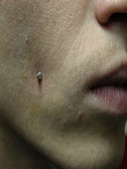Dreamtattoo Kad�k�y �stanbul Tek D�z Piercing Metalik